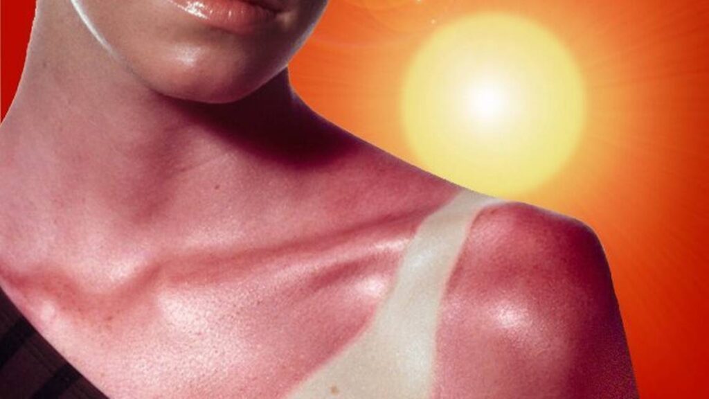 De Ultieme Gids voor Gezichtszonnebrandcrème: Bescherm Je Huid met BioCare Online