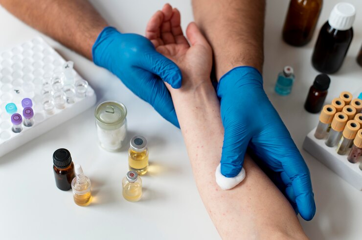 The Benefits of AllergyTest.co’s Comprehensive Allergy Testing: Accurate Results and Expert Insights