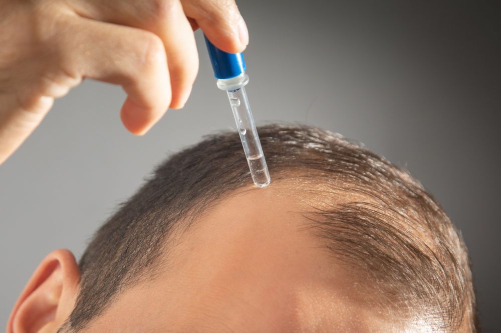 Oxford Online Pharmacy and Hair Loss from Steroids: Understanding the Issue and Solutions